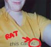 vass: Woman's torso with bulge circled and caption "rat". (Helpful diagram)